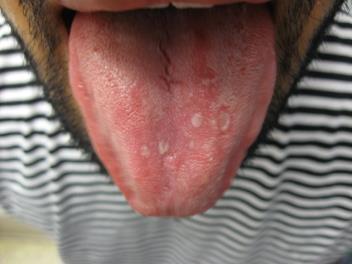 No evidence of infection with syphilis within the