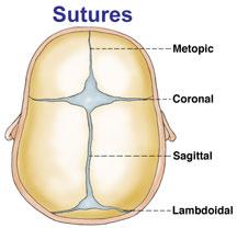 Suture Marks Cont d Coronal Suture: closed by age 50