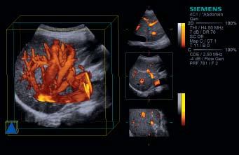 visualization of the pylorus in this pediatric abdomen.