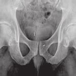 implantation in interventional radiology.