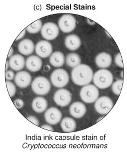 The capsule is tightly bound to the cell, and is associated with pathogenic bacteria.