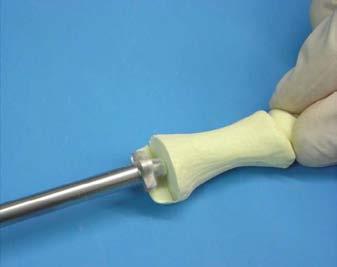 Select the appropriate size reamer, starting with Size 0, ensuring