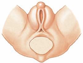 (b) Development of External Genitalia Bipotential stage: The external genitalia of a 6-week fetus