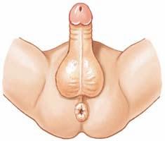 FEMALE MALE 10 weeks 10 weeks Clitoris Penis 26 Urethral fold Labioscrotal swelling Anus Anus