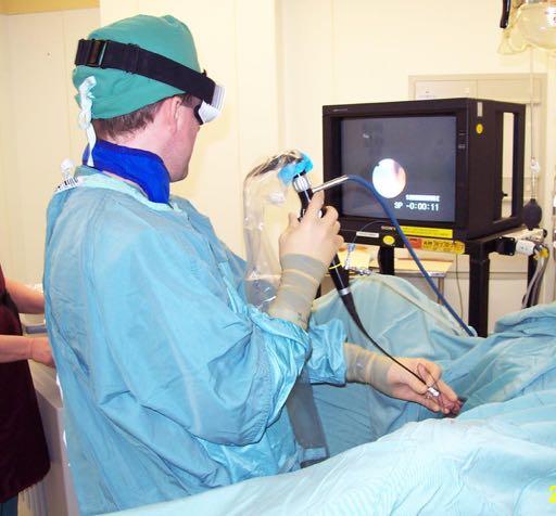 Pros and Cons of Ureteroscopy Ureteroscopy Pros Close to 100%