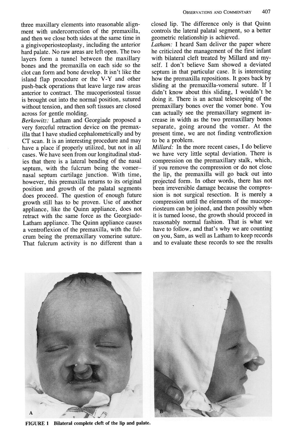 OBSERVATIONS AND COMMENTARY three maxillary elements into reasonable alignment with undercorrection of the premaxilla, and then we close both sides at the same time in a gingivoperiosteoplasty,