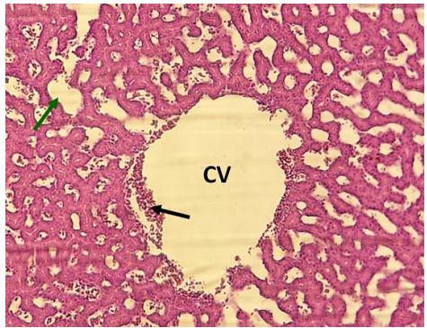 It was observed in the positive control that there is a severe haemorrhage of RBCs with the interlobular septum near the portal vein.