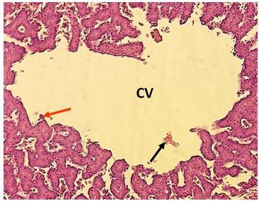 CV= Central vein Figure 8: Photomicrograph of the Anas platyrhynchos liver exposed to 2mg/mL of Ficus septica Burm. f. stem extracts.