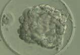 Embryo Cryopreservation Thaw Survival Rates Slow freeze/slow thaw