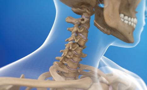 PROCEDURES WE PERFORM Stabilization Procedures Minimally invasive stabilization surgery aims to restore stability to the spine.