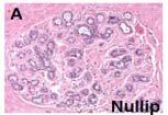 Dual effects of Pregnancy on Breast Cancer Development Stages of Breast Development Meier Abt Trends Mol Med.
