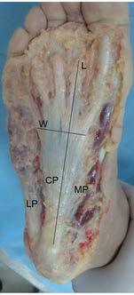 Anatomy 3 bands of dense connective tissue, which originate at the medial tubercle of