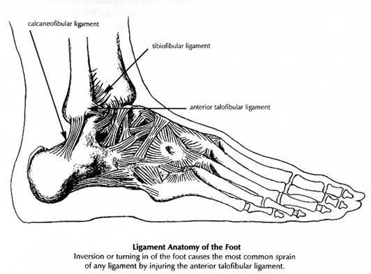 Lateral Ankle Sprain Anterior