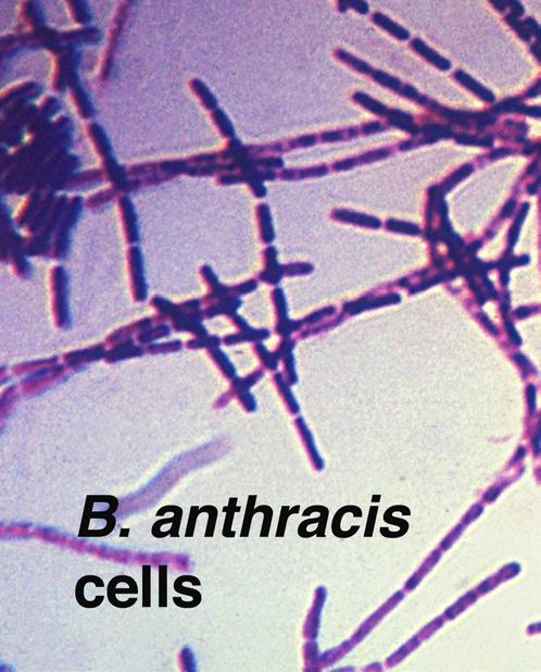 This lesson grapples with the problem of arriving at causation from correlation. In this lesson, we will re-visit Koch s postulates, and learn how he used them to prove that anthrax bacillus (B.