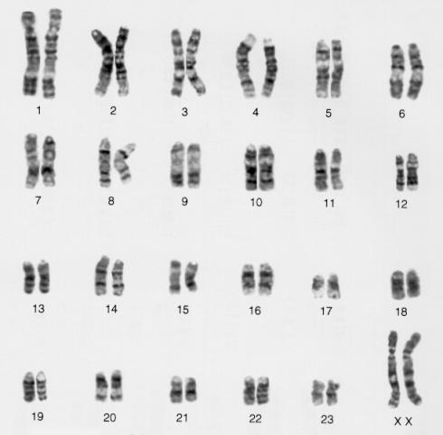 and procedures to produce a karyotype of the individual-checks to see if individual