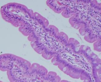 Normal duodenal tissue