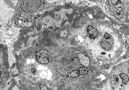 Glomerular staining of C3 with little/no staining