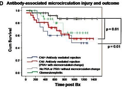 Recognition of C4d- AMR DSA + Microcirculatory injury DSA + increased