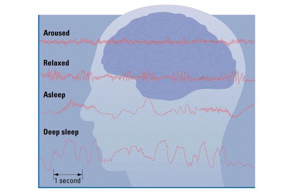 Electroencephalogram (EEG) Transcranial magnetic stimulation (TMS) A recording of neural activity detected by needle electrodes Involves delivering a large current