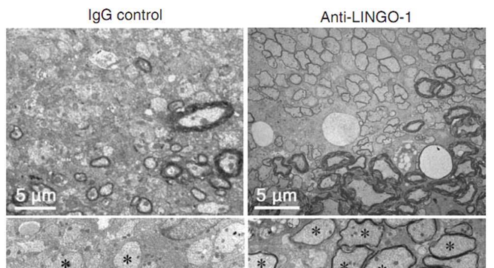 Promoting Natural Myelin Repair with Anti-LINGO LINGO-1 inhibits remyelination