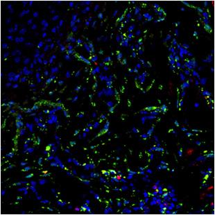 Reduced angiogenesis and osteoblast differentiation in ;ZsG mice at PSD7.