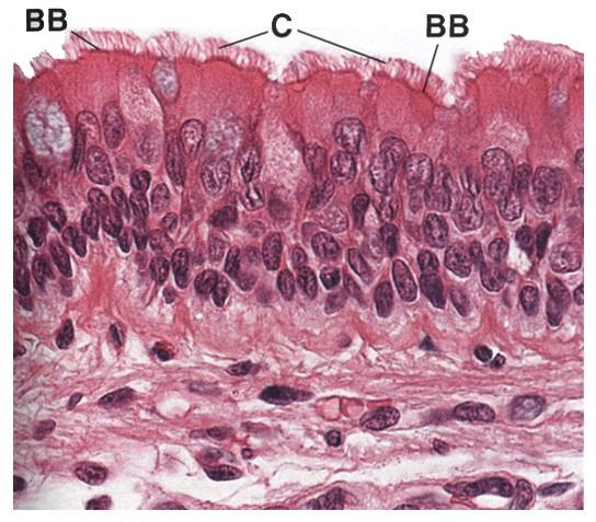 Pseudostratified columnar epithelium Locations : Lines the respiratory passages