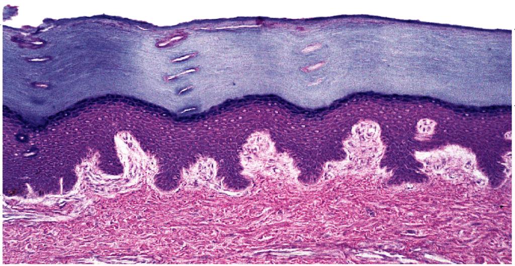Stratified squamous keratinized epithelium