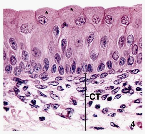 Transitional epithelium: Locations : Urinary tract: