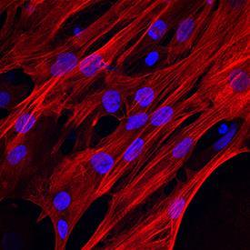 Cardiomyocytes Branched cells One