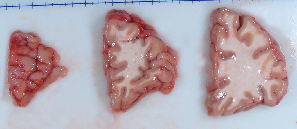 Cut Brain Sections - Cerebrum After bisecting the brain, it is cut