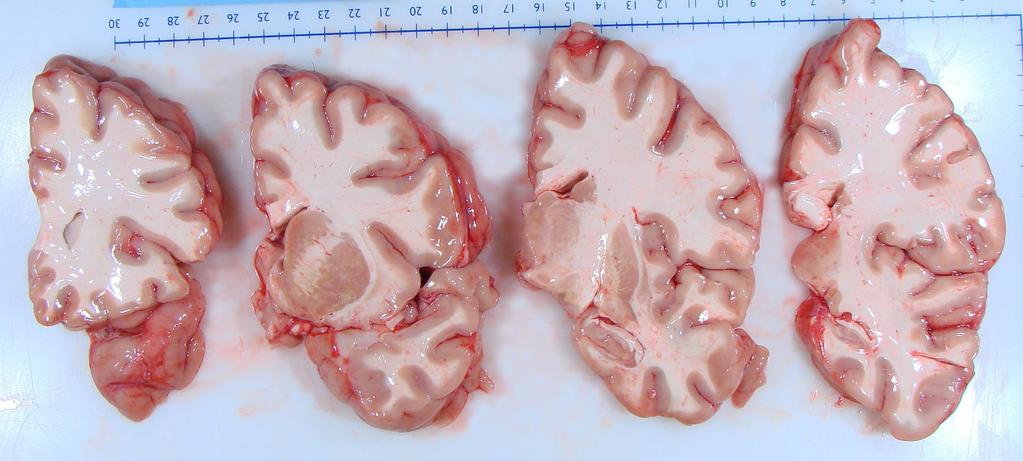 Cut Brain Sections - Cerebrum