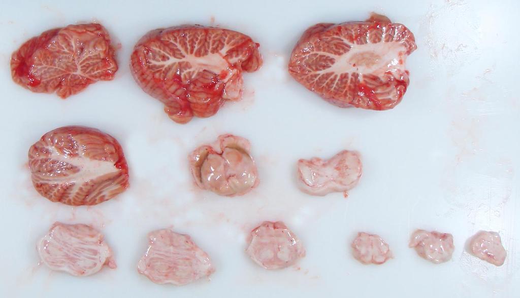 Cut Brain Sections - Cerebellum and Brain Stem Removed and processed separately, the