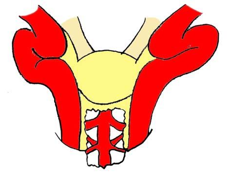 superior turbinate, to expose the lateral wall of the sphenoid sinus.