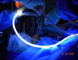 carotid arteries Proposed Advantages of EEA for Pituitary Surgery Improved Access for