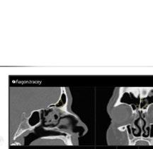 PHOTO REGISTRATION MEASURE PATIENTS WITH JUST A FEW CLICKS The revolution in ENT image