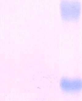 analysis of glycosylated recombinant proteins isolated from LEXSY! Ref.