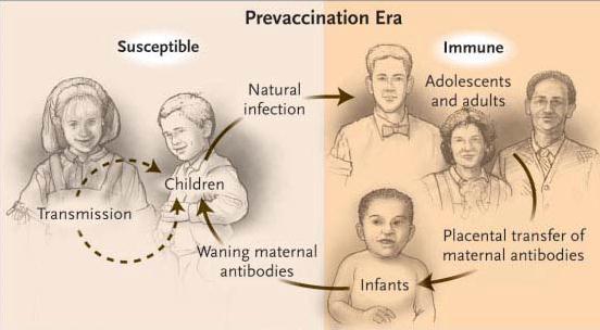 Before generalized use of pertussis vaccine