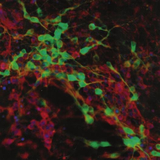 Figure 25 Courtesy of Dr. V. Nair. Dopaminergic nerve cells (green) derived from embryonic stem cells. Although stem cell research is promising, there are many obstacles still to be overcome.