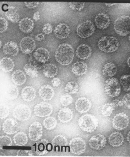 HPV 16 L1 VLPs - Virus like particles Virions Express the L1 gene