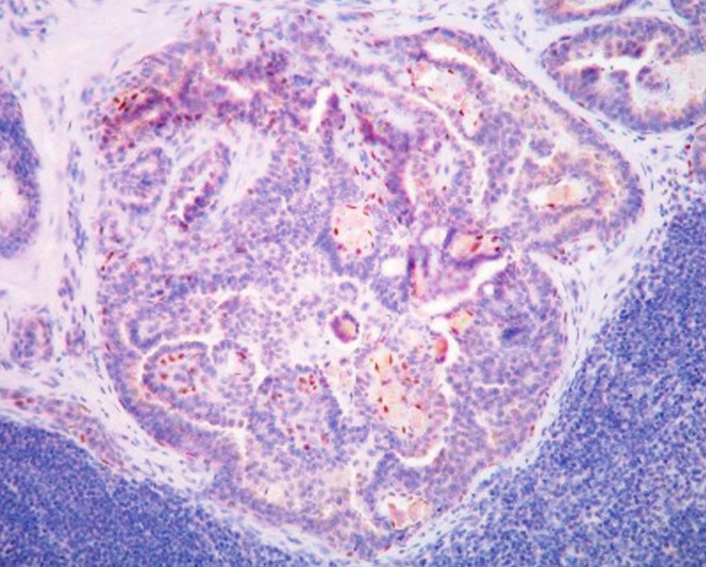 strongly highlighted a myoepithelial cell layer surrounding the glands