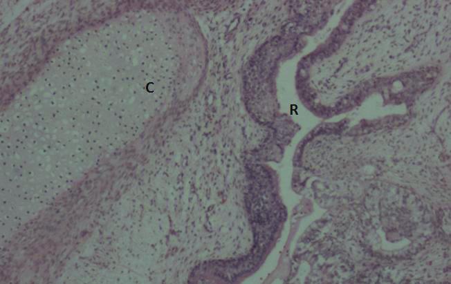 neural tissue [*] (Hematoxylin & Eosin, magnification