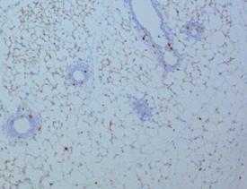 MPA nd RANKL induce prolifertion of mmmry epithelil cells.