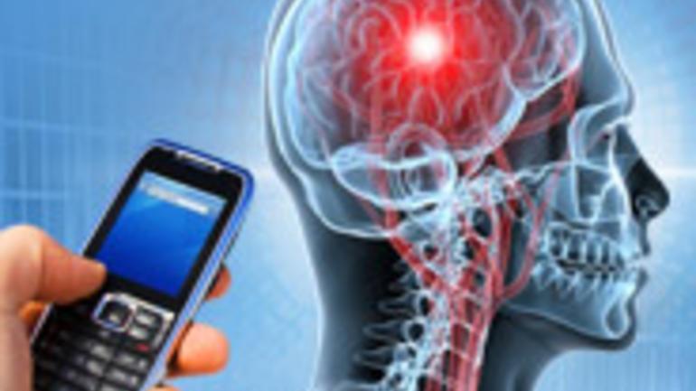 malignant type of brain cancer, associated with wireless phone use.