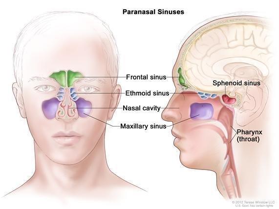 H&N TUMORS: Nasal and Paranasal Sinuses By their location, sinonasal tumors are