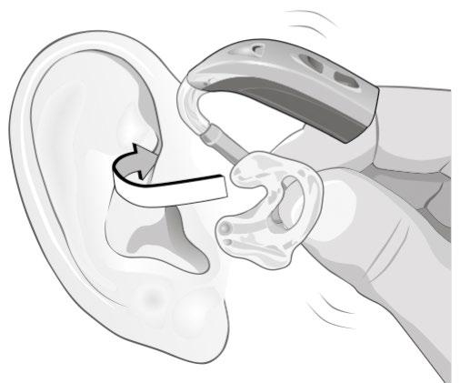Step 3a: Inserting Your Hearing Aid with an Earmold When inserting the right earmold, hold it with the right hand. When inserting the left earmold, hold it with the left hand.