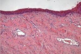 The mucosa aspect is typical of a premenopausal healthy epithelium with natural pink colour, no petechiae, evidence of vaginal rugae and mucous lubrication. [Courtesy of MG.