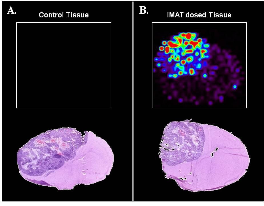 differences seen between the tumor and normal areas of the dosed brain images are not due to a difference in ionization effects of the tissue but are true differences in the amount of IMAT present in