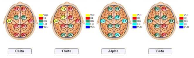 Brain Map provides us with the information that is required