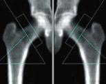 A wide set of clinical applications GE Healthcare s Windows -based encore software platform brings speed and automation to today s bone densitometry.
