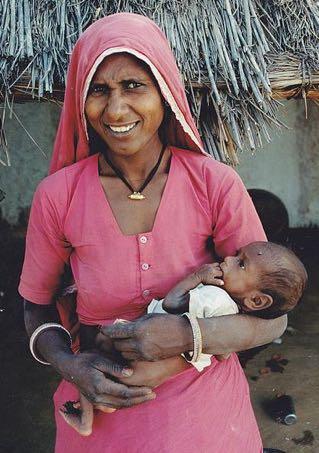 Four major causes contribute to about 60 % of all deaths in the newborn period: pre-maturity low birth weight birth asphyxia infections UNICEF India